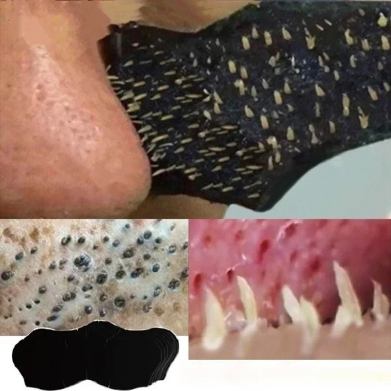 Unisex Blackhead Remove Mask N - Skincare Indonesia recensie en prijs